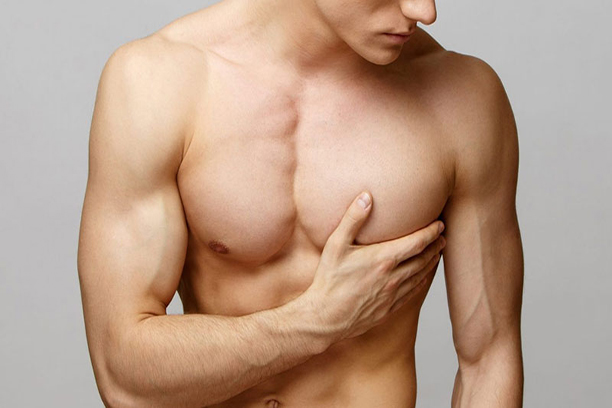 Gynecomastia