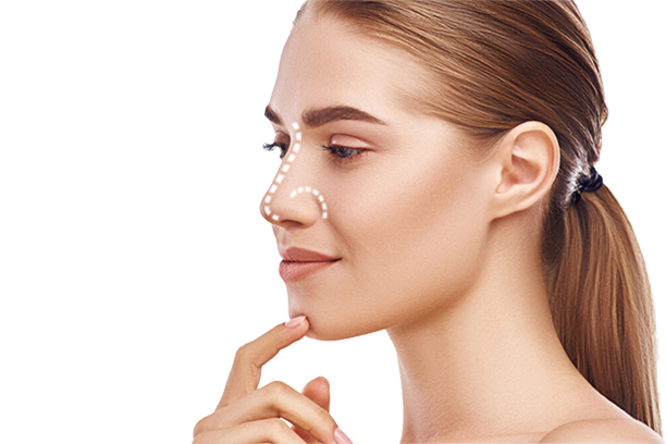 Rhinoplasty