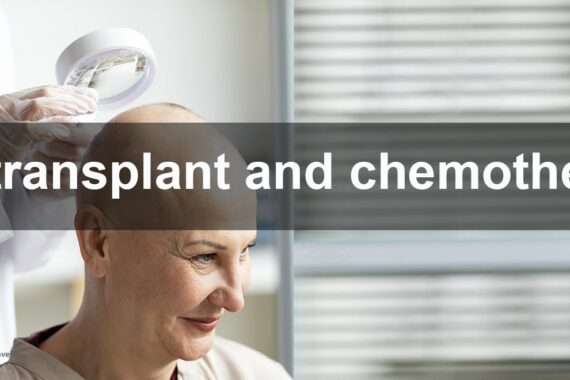Hair transplant and chemotherapy