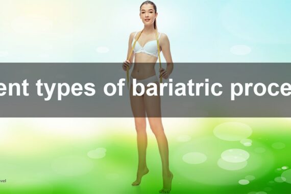 bariatric procedures
