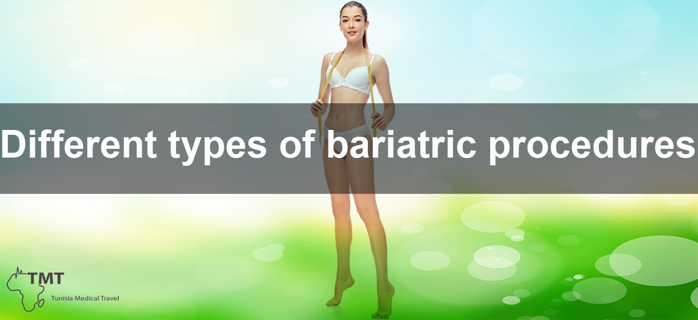 bariatric procedures