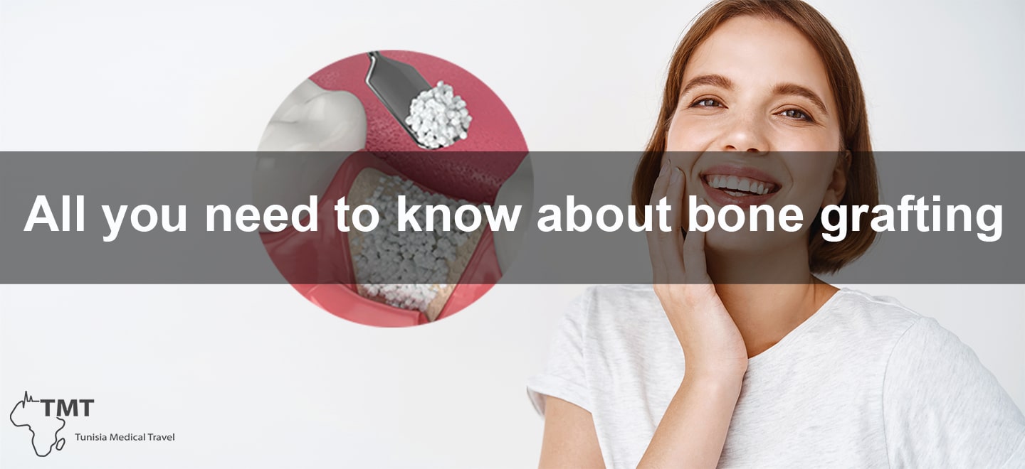 All you need to know about bone grafting