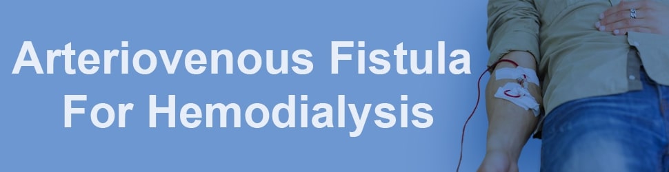 Arteriovenous Fistula for hemodialysis