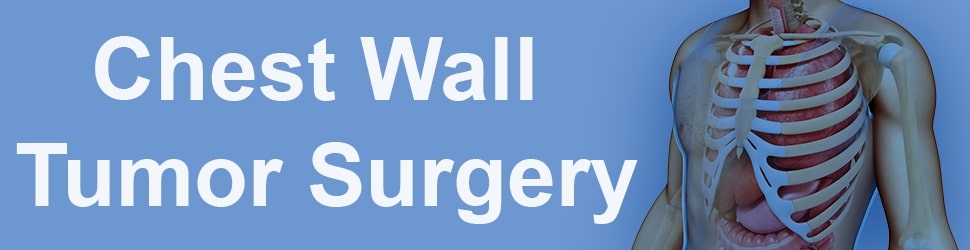 Chest wall tumor surgery
