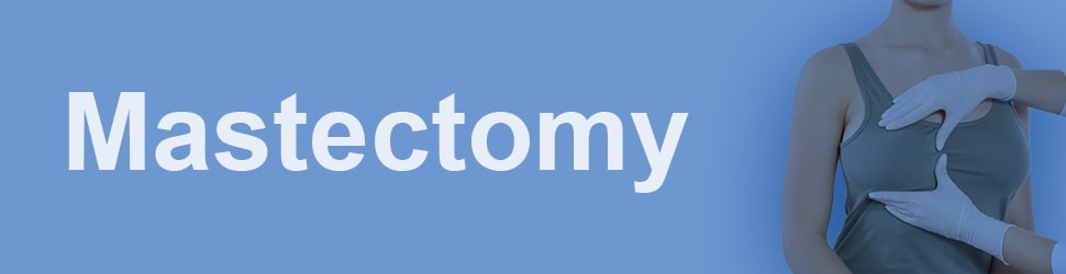 Mastectomy