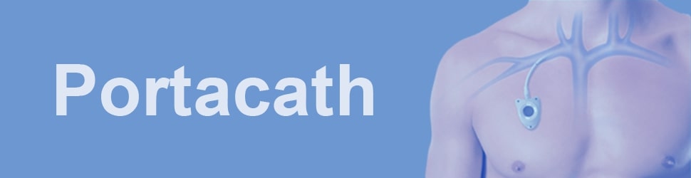 Portacath