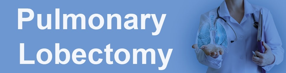 Pulmonary lobectomy