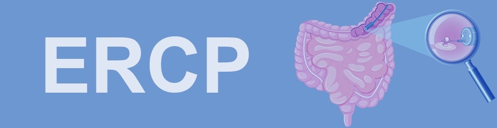 ERCP