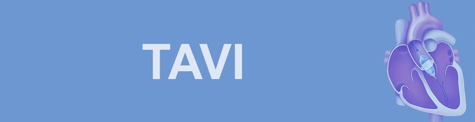 TAVI