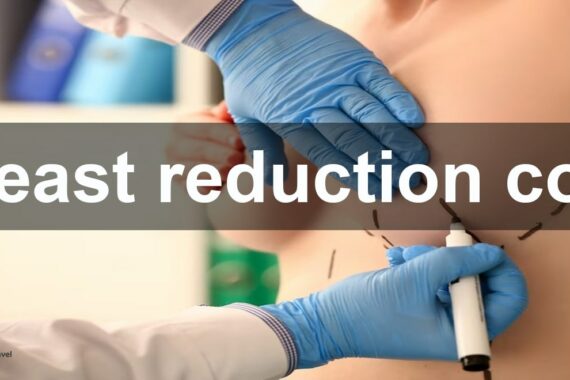 Breast reduction cost