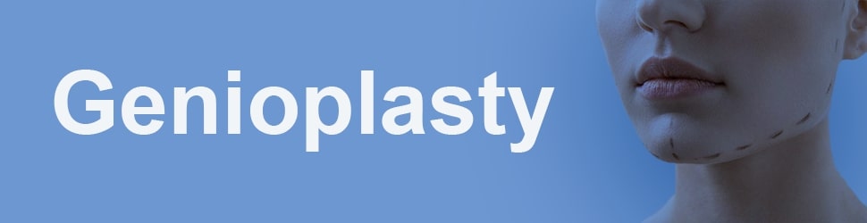 Genioplasty