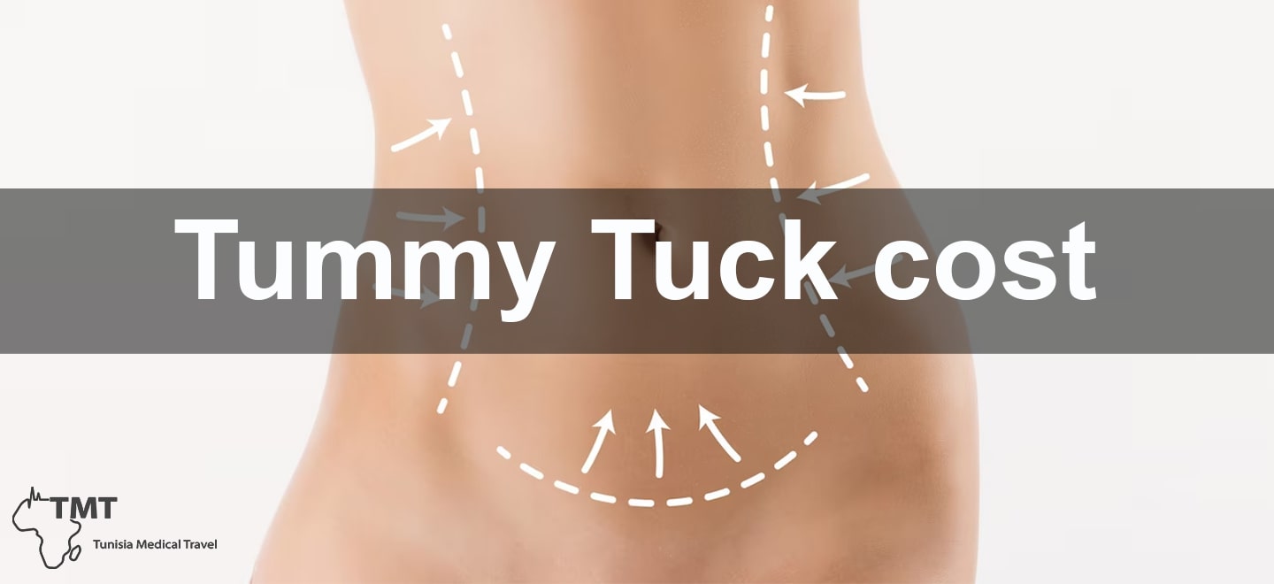 Tummy Tuck cost