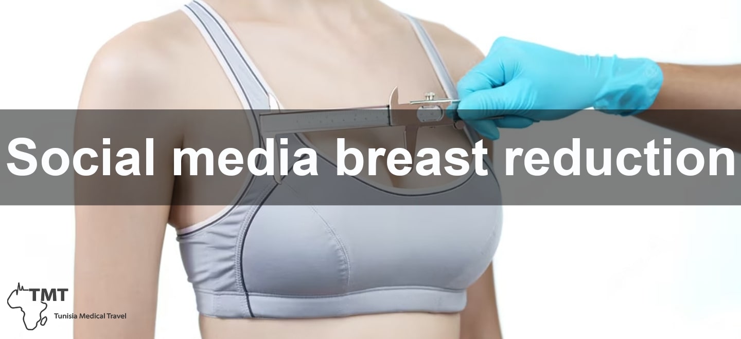 social media breast reduction
