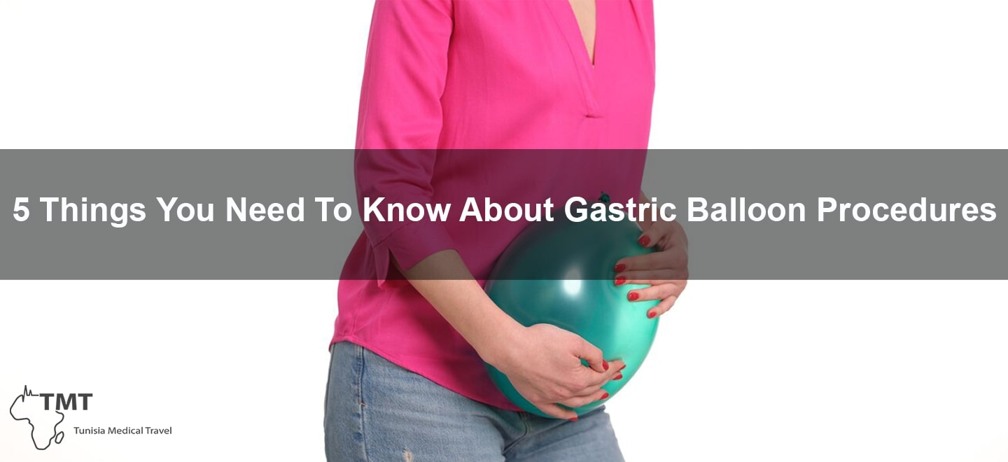 5 Things You Need To Know About Gastric Balloon Procedures