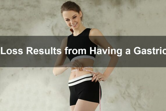 weight loss results of gastric sleeve