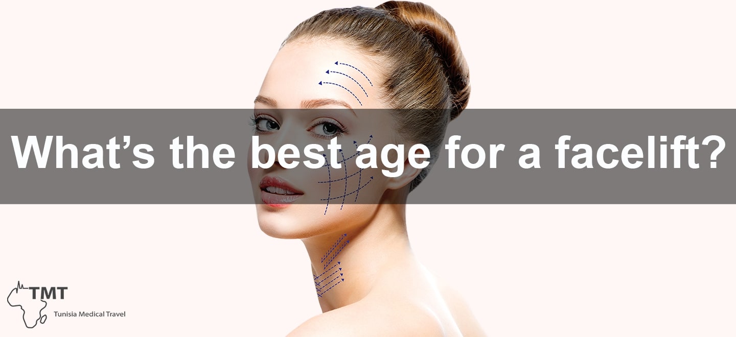 best age for a facelift