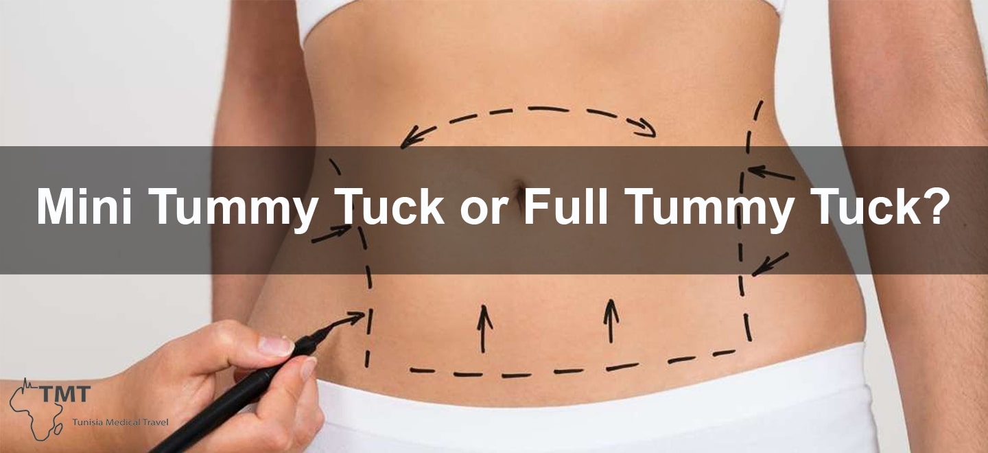 Tummy tuck surgery