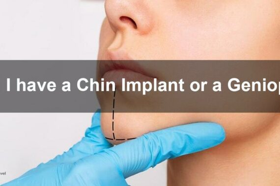Chin augmentation and genioplasty