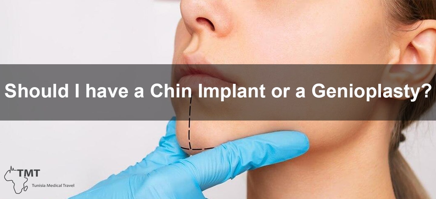 Chin augmentation and genioplasty