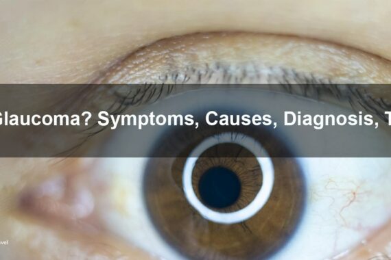 The glaucoma