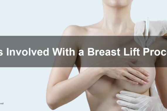 Breast lift procedure