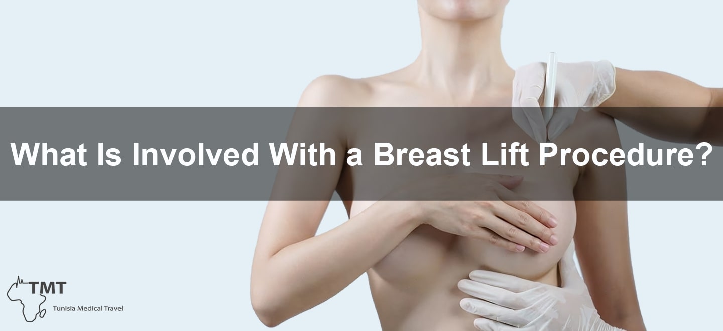 Breast lift procedure