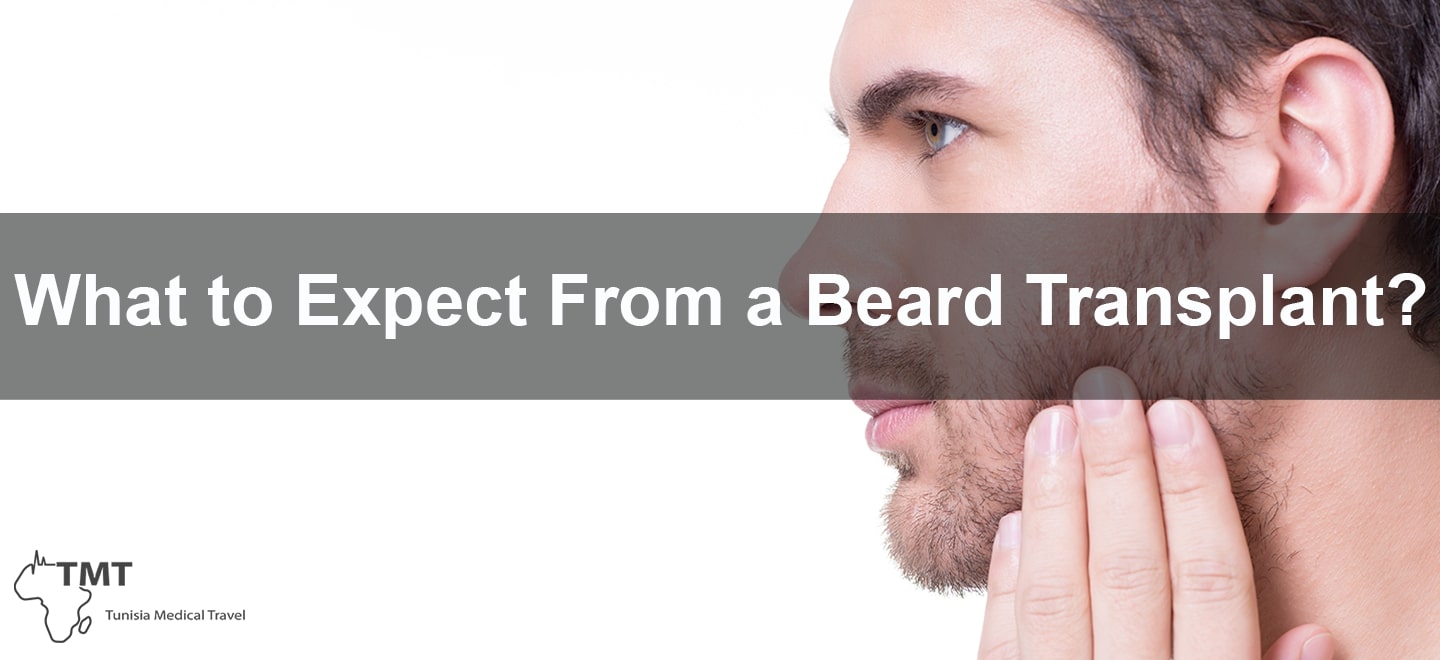 The beard transplant