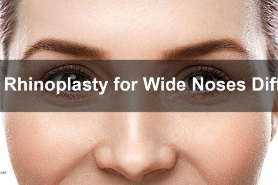 Wide Nose Rhinoplasty
