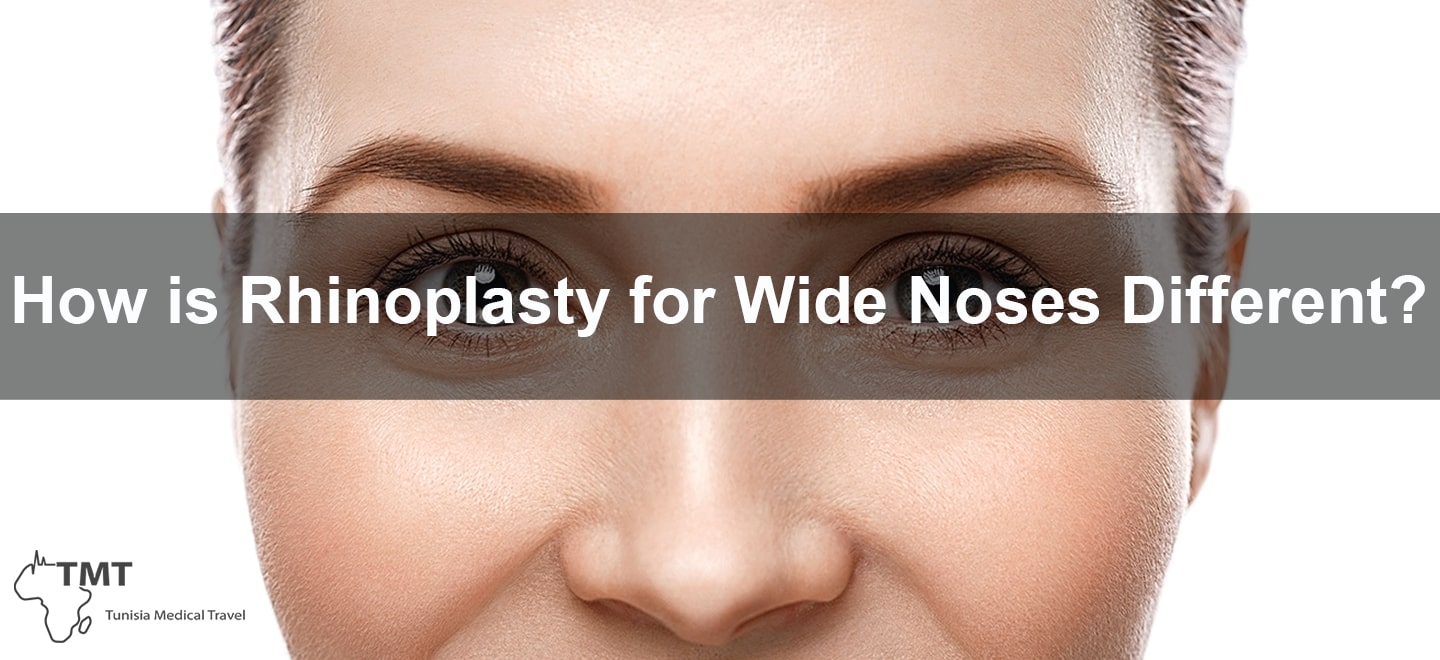 Wide Nose Rhinoplasty