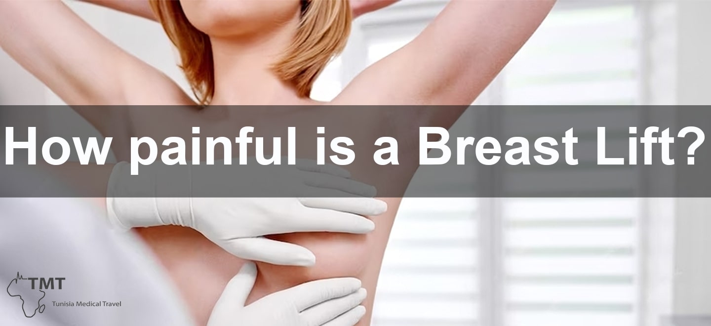 Breast lift