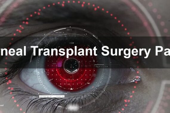 Cornea transplant surgery