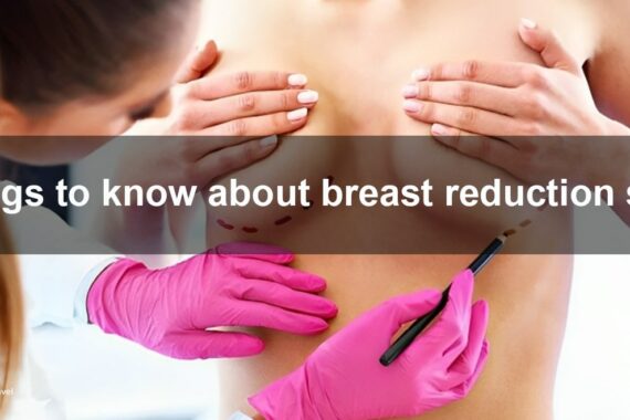 Breast reduction surgery