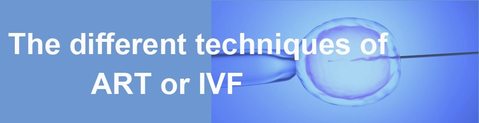 IVF Technology