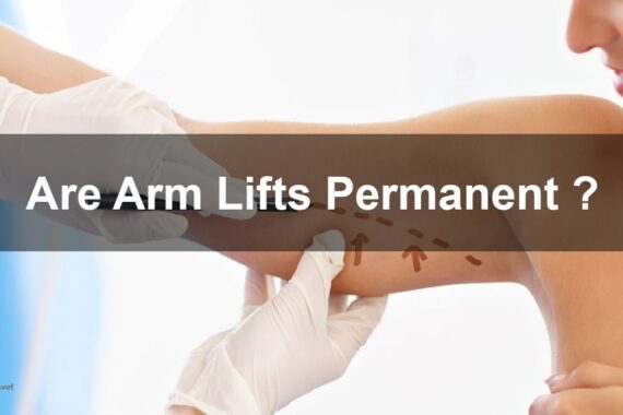 arm lifts permanence