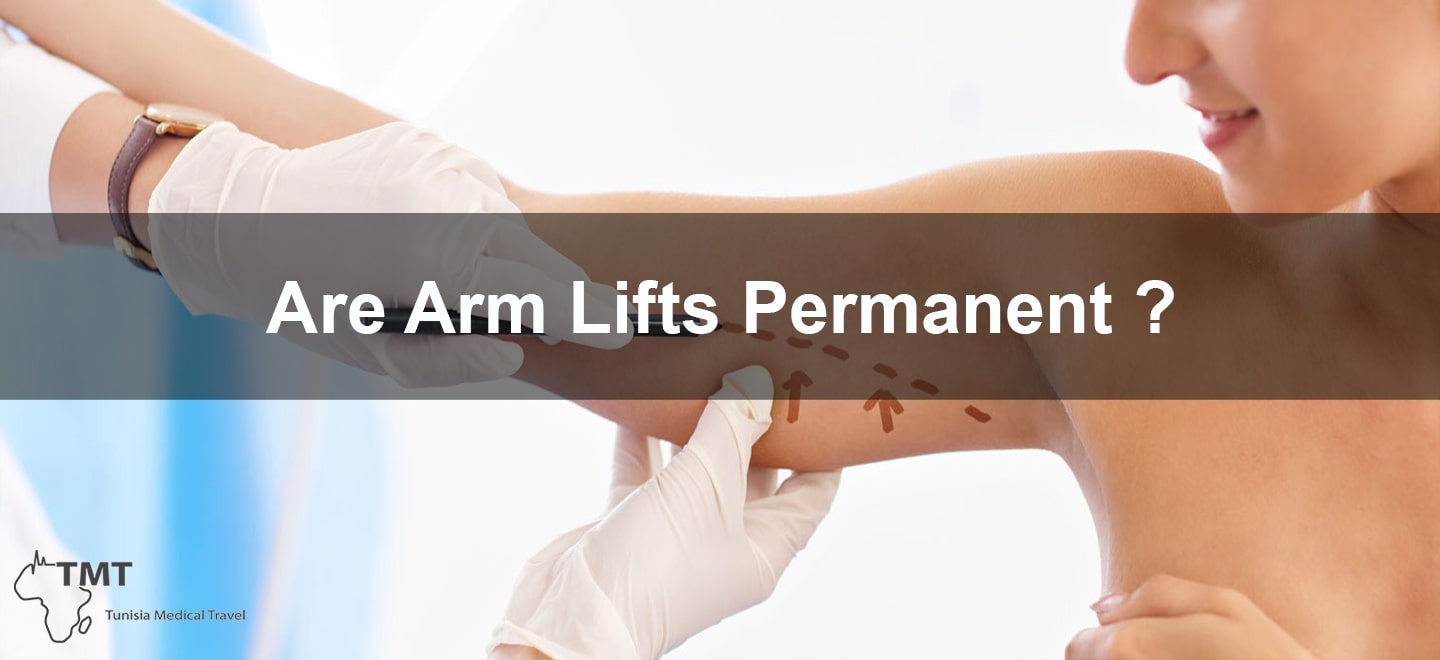 arm lifts permanence