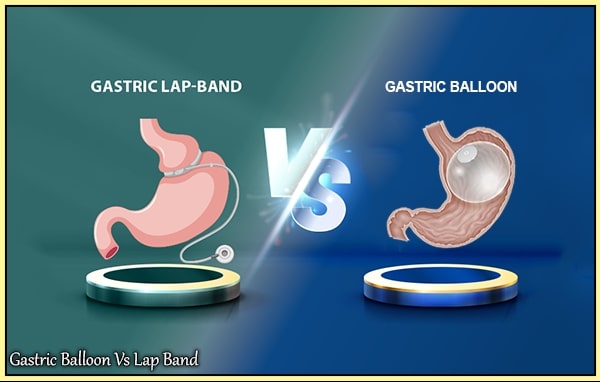 gastric balloon lap band