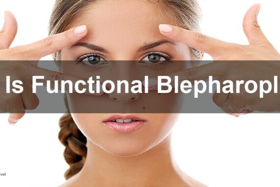 Functional Blepharoplasty
