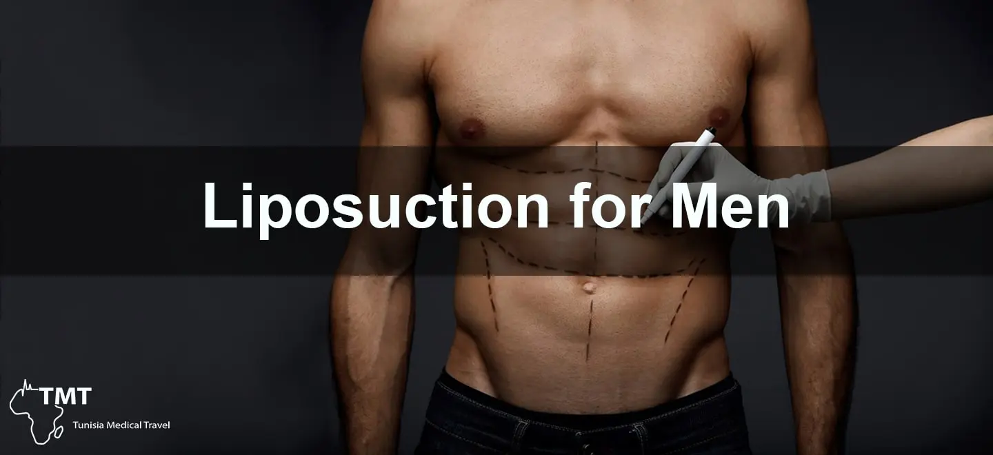Male Liposuction