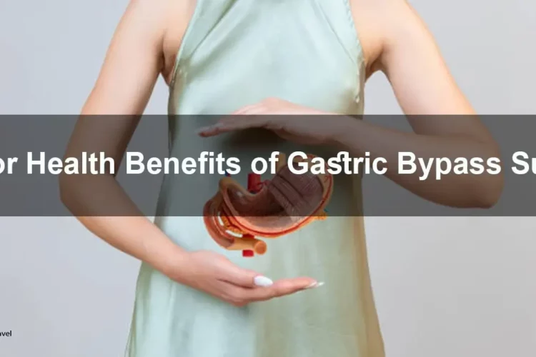 Gastric bypass surgery