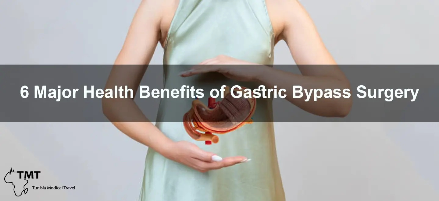 Gastric bypass surgery