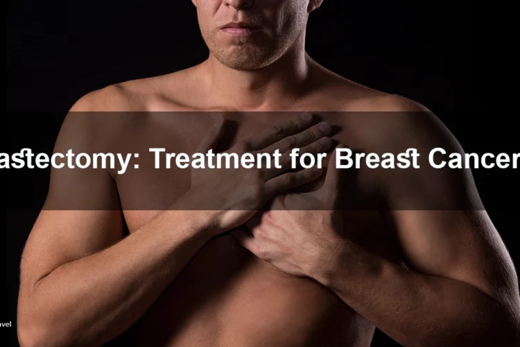 male mastectomy