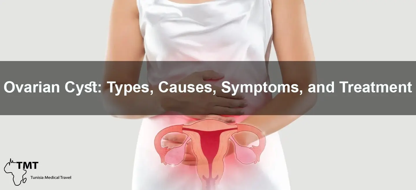 Ovarian cyst