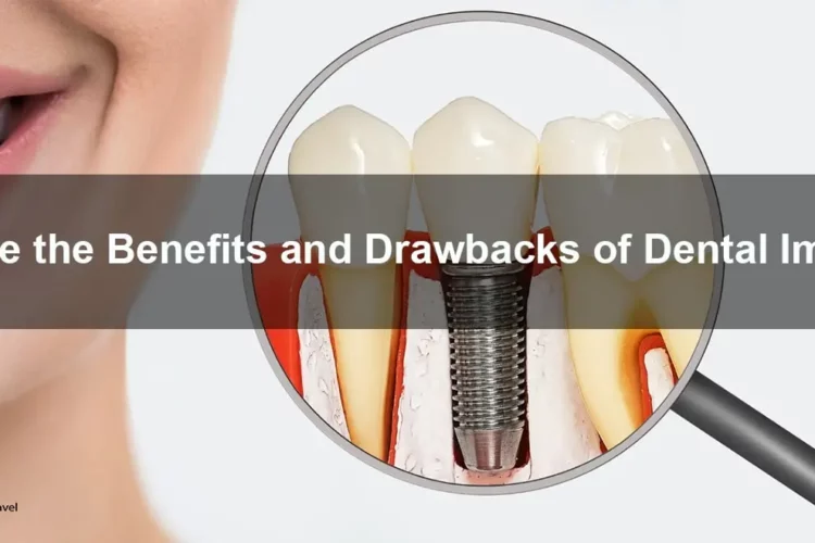A dental implants